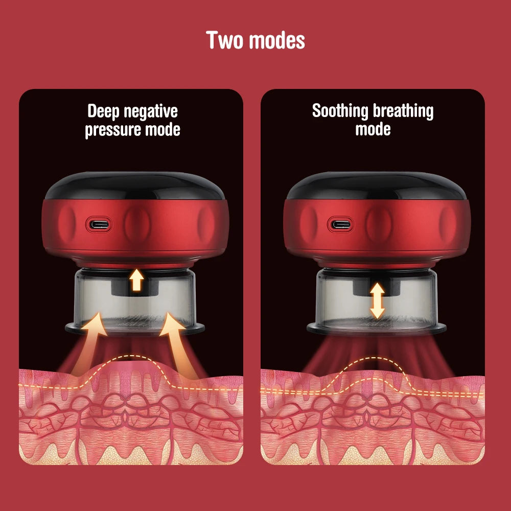 Smart Electric Body Cupping Massager with Heating & Suction for Ultimate Relaxation and Relief
